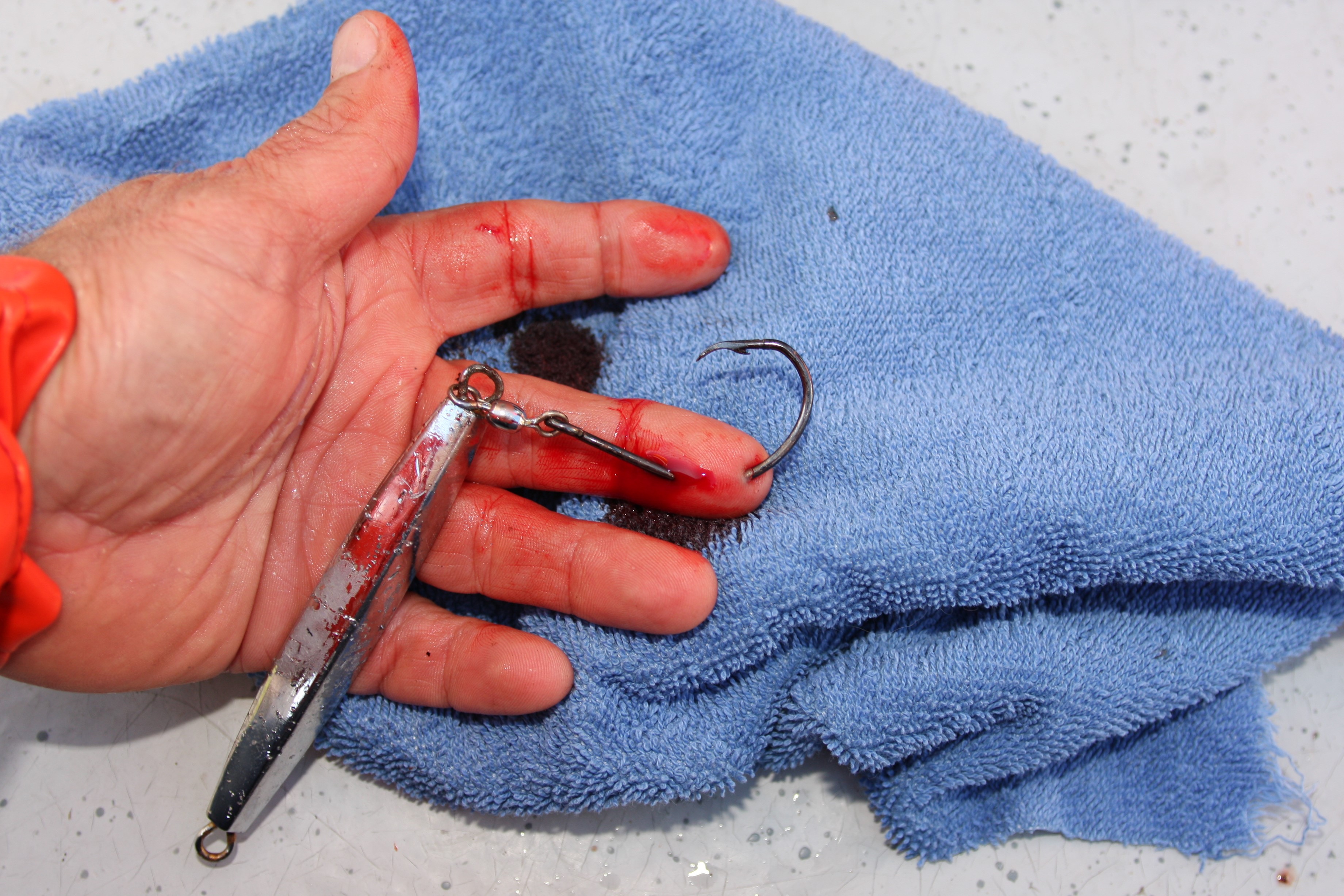 How to Remove a Fish Hook and Injury Prevention